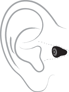 Invisible in canal hearing aid placement